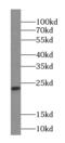 IMP U3 Small Nucleolar Ribonucleoprotein 3 antibody, FNab04297, FineTest, Western Blot image 
