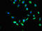Mannose-P-Dolichol Utilization Defect 1 antibody, LS-C396842, Lifespan Biosciences, Immunofluorescence image 