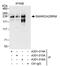 SWI/SNF Related, Matrix Associated, Actin Dependent Regulator Of Chromatin, Subfamily A, Member 2 antibody, A301-016A, Bethyl Labs, Immunoprecipitation image 