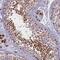 NUT Midline Carcinoma Family Member 1 antibody, ab122649, Abcam, Immunohistochemistry paraffin image 