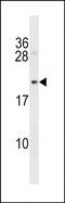 Protein B-Myc antibody, PA5-49078, Invitrogen Antibodies, Western Blot image 