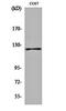 Protein Tyrosine Kinase 2 antibody, orb159519, Biorbyt, Western Blot image 