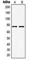 Guanylate Cyclase 1 Soluble Subunit Alpha 1 antibody, orb214026, Biorbyt, Western Blot image 