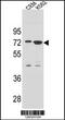 Zinc Finger Protein 324B antibody, 55-284, ProSci, Western Blot image 