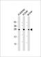 Erythropoietin antibody, 58-412, ProSci, Western Blot image 