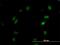 Serine/threonine-protein kinase OSR1 antibody, H00009943-M16, Novus Biologicals, Immunofluorescence image 
