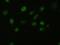 Fibroblast Growth Factor 2 antibody, GTX84502, GeneTex, Immunocytochemistry image 