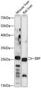 EBP Cholestenol Delta-Isomerase antibody, GTX66299, GeneTex, Western Blot image 