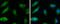 Hydroxysteroid 17-Beta Dehydrogenase 4 antibody, GTX114978, GeneTex, Immunofluorescence image 
