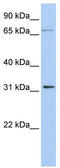 Isopentenyl-diphosphate Delta-isomerase 1 antibody, TA335079, Origene, Western Blot image 