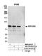 Protein Phosphatase 1 Regulatory Subunit 18 antibody, NBP2-59123, Novus Biologicals, Western Blot image 