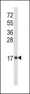 Neutrophil-activating protein 1 antibody, TA325052, Origene, Western Blot image 