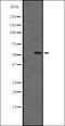 NIMA Related Kinase 2 antibody, orb335479, Biorbyt, Western Blot image 