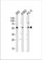 Phosphatidylinositol-4-Phosphate 5-Kinase Like 1 antibody, TA324394, Origene, Western Blot image 