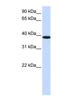 Kelch Domain Containing 8B antibody, NBP1-70592, Novus Biologicals, Western Blot image 