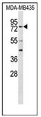 Regulatory Factor X3 antibody, AP53644PU-N, Origene, Western Blot image 