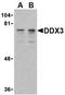 DEAD-Box Helicase 3 X-Linked antibody, TA306299, Origene, Western Blot image 