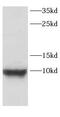 CART Prepropeptide antibody, FNab01278, FineTest, Western Blot image 
