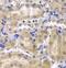 Ribosomal Protein L5 antibody, FNab07440, FineTest, Immunohistochemistry paraffin image 