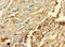 Chromosome 2 Open Reading Frame 83 antibody, A65142-100, Epigentek, Immunohistochemistry paraffin image 