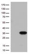 Nicotinamide Riboside Kinase 2 antibody, LS-C793184, Lifespan Biosciences, Western Blot image 