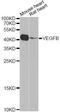 Vascular Endothelial Growth Factor B antibody, A2132, ABclonal Technology, Western Blot image 