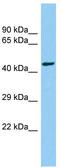 Centrosomal Protein 85 Like antibody, TA331500, Origene, Western Blot image 