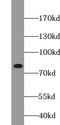 ATP Binding Cassette Subfamily B Member 10 antibody, FNab00030, FineTest, Western Blot image 