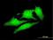Ubiquitination Factor E4A antibody, H00009354-M08, Novus Biologicals, Immunofluorescence image 