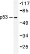p53 antibody, AP06267PU-N, Origene, Western Blot image 