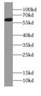 LRG antibody, FNab02108, FineTest, Western Blot image 