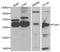 Fatty Acid Amide Hydrolase antibody, A1174, ABclonal Technology, Western Blot image 