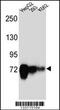 Cadherin 22 antibody, 56-945, ProSci, Western Blot image 