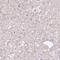 Colipase antibody, HPA010512, Atlas Antibodies, Immunohistochemistry frozen image 
