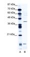 CAMP Responsive Element Modulator antibody, orb329794, Biorbyt, Western Blot image 