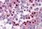 Coronin 1B antibody, orb89794, Biorbyt, Immunohistochemistry paraffin image 