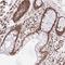 SET Nuclear Proto-Oncogene antibody, HPA063683, Atlas Antibodies, Immunohistochemistry frozen image 