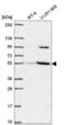 Solute Carrier Family 37 Member 3 antibody, NBP2-57417, Novus Biologicals, Western Blot image 