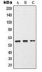 Cytochrome P450 Family 2 Subfamily C Member 9 antibody, GTX56285, GeneTex, Western Blot image 