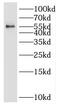 Prolyl 3-Hydroxylase Family Member 4 (Non-Enzymatic) antibody, FNab07619, FineTest, Western Blot image 