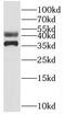 SGT1 Homolog, MIS12 Kinetochore Complex Assembly Cochaperone antibody, FNab08374, FineTest, Western Blot image 
