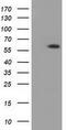 Pantothenate kinase 2, mitochondrial antibody, GTX83946, GeneTex, Western Blot image 