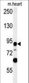 Leucine Rich Repeat Containing 36 antibody, LS-C165879, Lifespan Biosciences, Western Blot image 