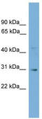 Gap Junction Protein Gamma 3 antibody, TA329549, Origene, Western Blot image 