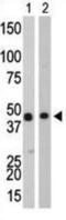 Creatine Kinase B antibody, abx033151, Abbexa, Western Blot image 