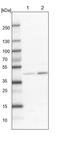 Acyl-CoA Synthetase Long Chain Family Member 6 antibody, PA5-59191, Invitrogen Antibodies, Western Blot image 