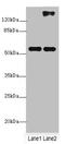 Histone Deacetylase 1 antibody, A68304-100, Epigentek, Western Blot image 