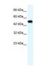 Zinc Finger Protein 778 antibody, NBP1-80195, Novus Biologicals, Western Blot image 