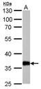 Aldo-keto reductase family 1 member C1 antibody, LS-B10819, Lifespan Biosciences, Western Blot image 