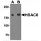 Histone Deacetylase 6 antibody, TA349074, Origene, Western Blot image 